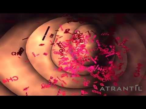 Learn About What Causes Bloating