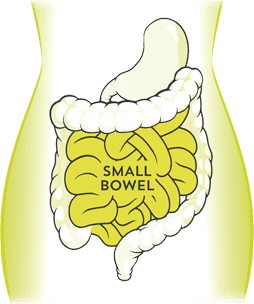 small-bowel what is SIBO? SIBO treatment - Atrantil