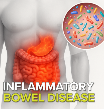 What is inflammatory bowel disease (IBD)?