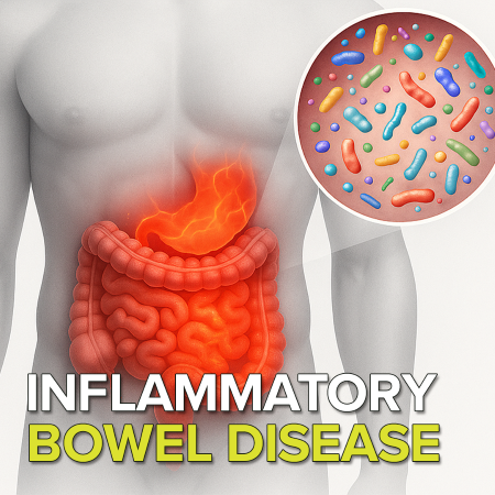 What is inflammatory bowel disease (IBD)?
